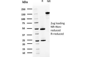 SDS-PAGE Analysis Purified S100A4 Mouse Monoclonal Antibody (CPTC-S100A4-3). (s100a4 anticorps)