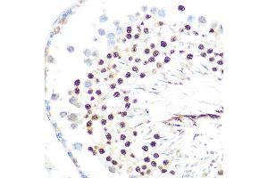 Immunohistochemistry of paraffin-embedded mouse testis using HP1 alpha/CBX5Rabbit mAb (ABIN1678748, ABIN3018030, ABIN3018031 and ABIN7101571) at dilution of 1:100 (40x lens).