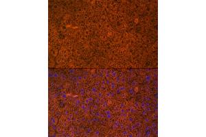 Immunofluorescence analysis of mouse liver cells using PAH Rabbit mAb (ABIN7269264) at dilution of 1:25 (40x lens). (Phenylalanine Hydroxylase anticorps)