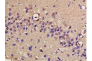 Formalin-fixed and paraffin embedded rat brain labeled with Rabbit Anti-ERCC8/CSA Polyclonal Antibody, Unconjugated (ABIN1713778) at 1:200 followed by conjugation to the secondary antibody and DAB staining (ERCC8 anticorps  (AA 161-260))