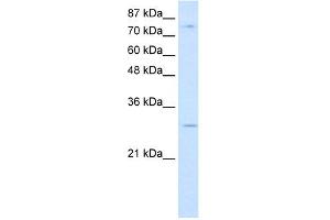 WB Suggested Anti-RBM28 Antibody Titration:  0. (RBM28 anticorps  (C-Term))