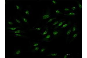 Immunofluorescence of purified MaxPab antibody to ZCCHC9 on HeLa cell. (ZCCHC9 anticorps  (AA 1-271))