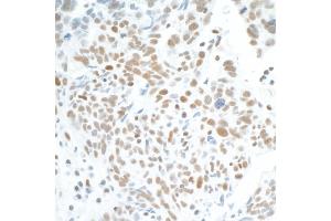 anti-Cyclin-Dependent Kinase 7 (CDK7) (AA 300-346) antibody