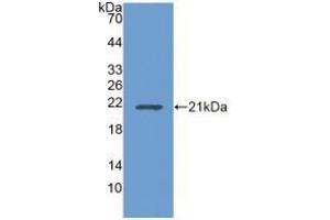 Detection of Recombinant UBE2L3, Human using Polyclonal Antibody to Ubiquitin Conjugating Enzyme E2L3 (UBE2L3) (UBE2L3 anticorps  (AA 4-154))