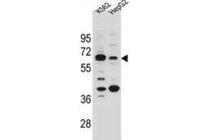 Western Blotting (WB) image for anti-Na+/H+ Exchanger Domain Containing 1 (NHEDC1) antibody (ABIN2996071) (NHEDC1 anticorps)