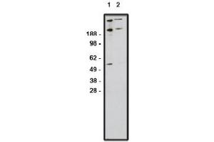 Image no. 1 for anti-Zinc Finger Protein GLI1 (GLI1) antibody (ABIN4620372) (GLI1 anticorps)