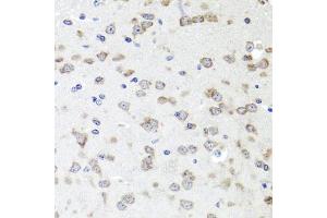 Immunohistochemistry of paraffin-embedded mouse brain using IGFBP5 antibody (ABIN6130485, ABIN6142257, ABIN6142259 and ABIN6216084) at dilution of 1:100 (40x lens). (IGFBP5 anticorps  (AA 68-167))