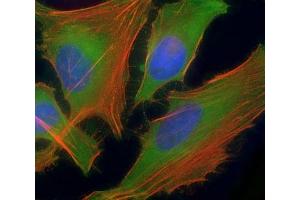 Immunofluorescent staining of permeabilized human HeLa cells with ASS1 antibody at 1:25 dilution, followed by Dylight 488-conjugated goat anti-rabbit lgG (green). (ASS1 anticorps  (AA 192-221))