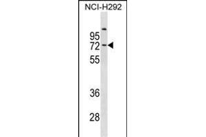 COL9A3 Antibody (Center) (ABIN1881221 and ABIN2838976) western blot analysis in NCI- cell line lysates (35 μg/lane). (COL9A3 anticorps  (AA 501-528))