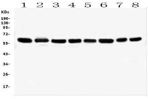 Western blot analysis of HSPD1 using anti-HSPD1 antibody (ABIN7600976). (HSPD1 anticorps  (AA 260-496))