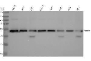 Western blot analysis of PRDX3 using anti-PRDX3 antibody (ABIN7605915).