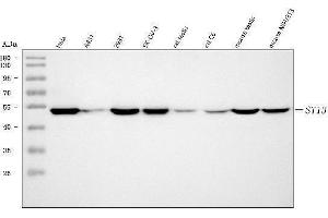 Western blot analysis of ST13 using anti-ST13 antibody (ABIN7600493).