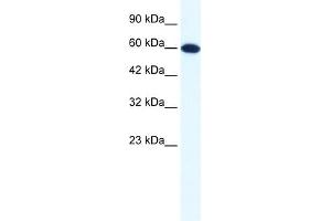 WB Suggested Anti-DDX6 Antibody Titration:  1. (DDX6 anticorps  (N-Term))