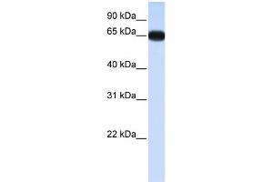 WB Suggested Anti-DLX4 Antibody Titration:  0. (DLX4 anticorps  (N-Term))