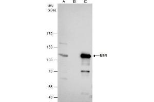 IP Image NBS1 antibody immunoprecipitates nibrin protein in IP experiments. (Nibrin anticorps)