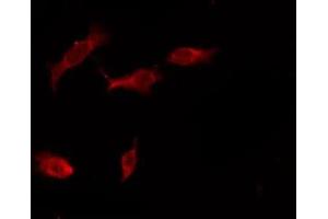 ABIN6276160 staining HeLa by IF/ICC. (OR4X1 anticorps  (C-Term))
