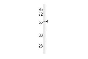Western blot analysis of CYP2C19 Antibody (Center) (ABIN390665 and ABIN2840960) in Jurkat cell line lysates (35 μg/lane).