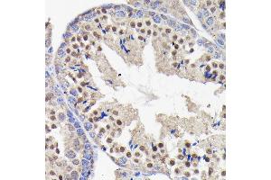 Immunohistochemistry of paraffin-embedded mouse testis using PI3 Kinase p85 beta Rabbit mAb (ABIN1679407, ABIN3019246, ABIN3019247 and ABIN7101736) at dilution of 1:100 (40x lens).