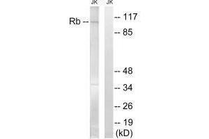 Western blot analysis of extracts from Jurkat cells, treated with PMA (125 ng/mL, 30 mins), using Retinoblastoma (Ab-608) antibody.
