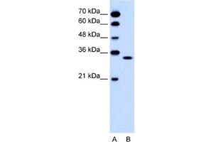 Western Blotting (WB) image for anti-Olfactory Receptor, Family 5, Subfamily T, Member 2 (OR5T2) antibody (ABIN2462482) (OR5T2 anticorps)