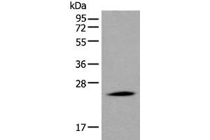 Western blot analysis of Human liver tissue lysate using APOD Polyclonal Antibody at dilution of 1:550 (Apolipoprotein D anticorps)