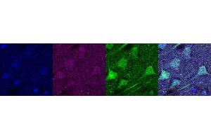 Immunohistochemistry (IHC) image for anti-Ubiquitin Carboxyl-terminal Esterase L1 (Ubiquitin Thiolesterase) (UCHL1) antibody (ABIN7456167) (UCHL1 anticorps)