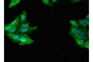 Immunofluorescent analysis of Hela cells using ABIN7154436 at dilution of 1:100 and Alexa Fluor 488-congugated AffiniPure Goat Anti-Rabbit IgG(H+L) (GAB2 anticorps  (AA 273-484))