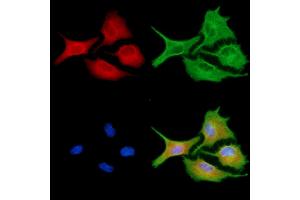 ABIN6256861 and ABIN6273953 staining  cells by IF/ICC. (NPY4R anticorps  (N-Term))