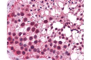 Human Testis; Testis; KLF9 Antibody - N-terminal region in Human Testis cells using Immunohistochemistry (KLF9 anticorps  (N-Term))