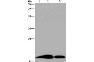 Western Blot analysis of Human brain malignant glioma, Mouse kidney and Human kidney tissue using REG3G Polyclonal Antibody at dilution of 1:250