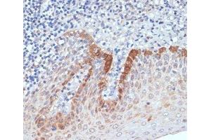 Immunohistochemistry of paraffin-embedded Human tonsil using CXCL12 Polyclonal Antibody at dilution of 1:100 (40x lens). (CXCL12 anticorps)