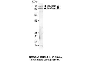 Image no. 2 for anti-Erythrocyte Membrane Protein Band 4.1 Like 3 (EPB41L3) (AA 400-500), (Internal Region) antibody (ABIN363626)