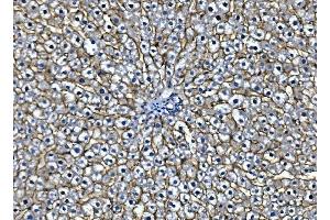 IHC analysis of EGFR using anti-EGFR antibody (ABIN7600915). (EGFR anticorps  (AA 25-596))