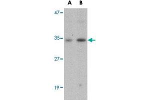 Western blot analysis of GNPDA1 in mouse kidney tissue lysate with GNPDA1 polyclonal antibody  at (A) 1 and (B) 2 ug/mL . (GNPDA1 anticorps  (C-Term))