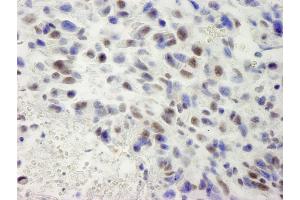 Immunohistochemistry (IHC) image for anti-hSET1 (AA 1200-1250) antibody (ABIN7448601) (hSET1 (AA 1200-1250) anticorps)