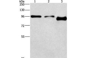 Western Blot analysis of A431 and hela cell,Mouse brain tissue using PIP5K1C Polyclonal Antibody at dilution of 1:500 (PIP5K1C anticorps)