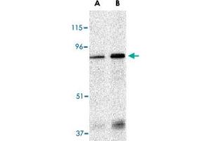 Western blot analysis of EIF2AK2 in Caco-2 whole cell lysate with EIF2AK2 polyclonal antibody  at (A) 1 and (B) 2 ug/mL . (EIF2AK2 anticorps  (N-Term))