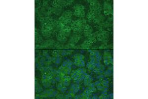 anti-Cystathionine-beta-Synthase (CBS) (AA 252-551) antibody