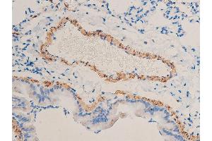 ABIN6267068 at 1/100 staining rat lung tissue sections by IHC-P.