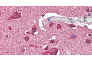 Immunohistochemistry of paraffin-embedded Brain, Cortex tissue using SLC8A3 Polyclonal Antibody at dilution of 1:50. (SLC8A3 anticorps)