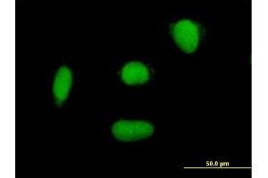 Immunofluorescence of purified MaxPab antibody to ELAC2 on HepG2 cell. (ELAC2 anticorps  (AA 1-826))