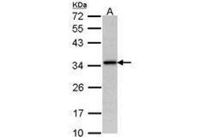 Image no. 1 for anti-N-Acetyltransferase 1 (Arylamine N-Acetyltransferase) (NAT1) (AA 1-157) antibody (ABIN467615) (NAT1 anticorps  (AA 1-157))