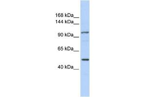WB Suggested Anti-KIAA1618 Antibody Titration:  0.