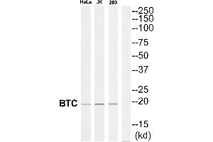 Western blot analysis of extracts from 293/Jurkat/HeLa cells, using BTC antibody. (Betacellulin anticorps  (Internal Region))