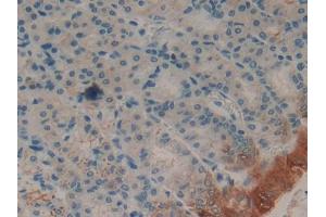 Used in DAB staining on fromalin fixed paraffin- embedded spleen tissue (FABP2 anticorps  (AA 2-132))