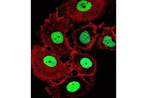 anti-Homeobox C10 (HOXC10) (AA 152-179) antibody
