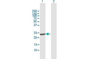 Western Blot analysis of DTYMK expression in transfected 293T cell line by DTYMK MaxPab polyclonal antibody.