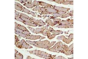 Immunohistochemical analysis of Beta2A-tubulin staining in mouse skeletal muscle formalin fixed paraffin embedded tissue section. (TUBB2A anticorps)