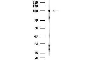 anti-Premelanosome Protein (PMEL) (C-Term) antibody