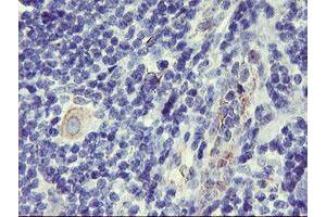Immunohistochemistry (IHC) image for anti-Dipeptidyl-Peptidase 9 (DPP9) antibody (ABIN1497899)